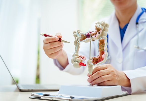 Colon and rectum digestive disease services