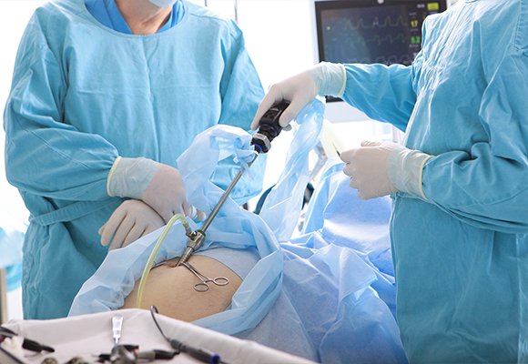 Hernia digestive disease services