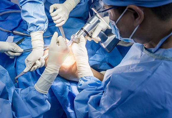 Joint replacement